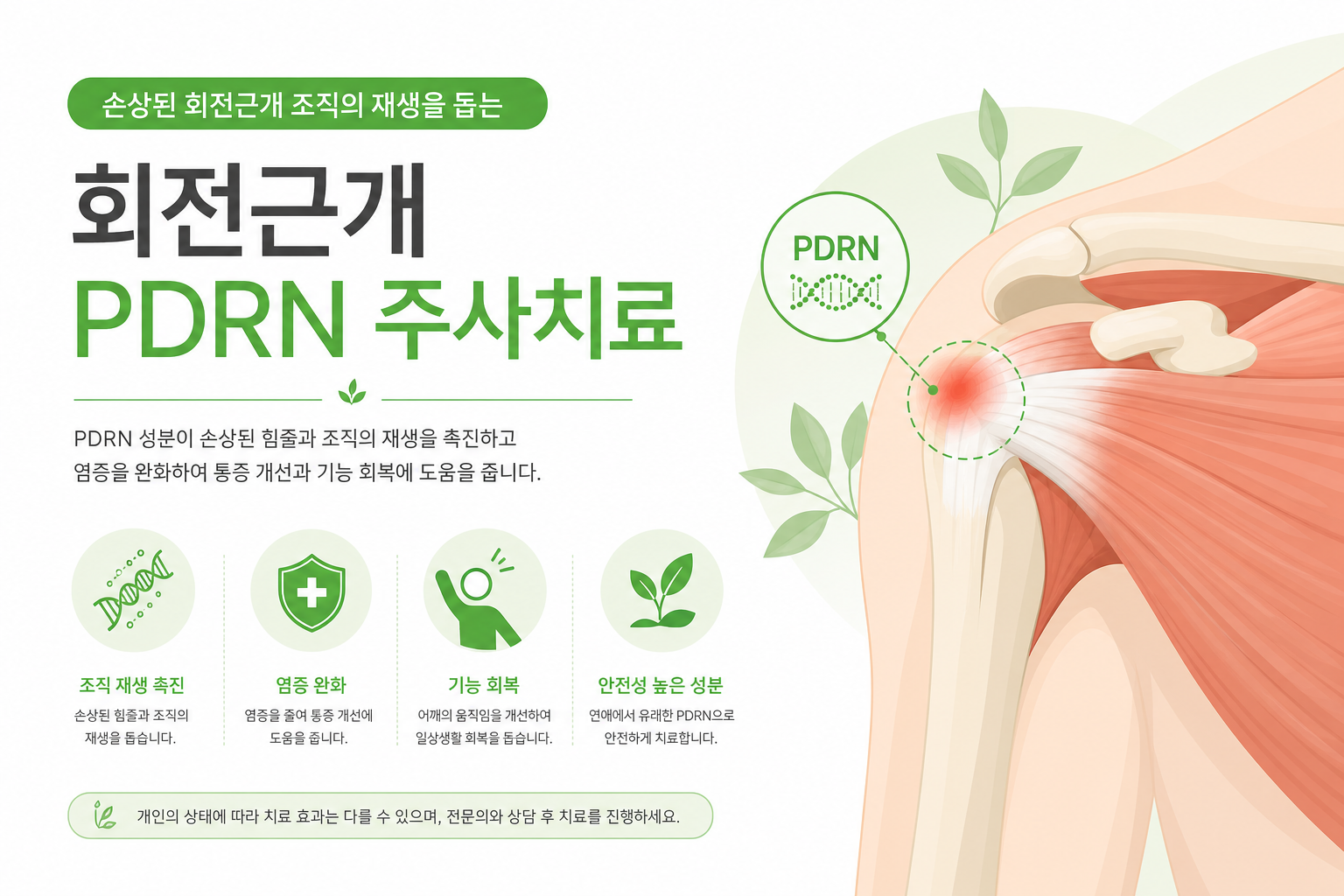 PDRN 작용기전 인포그래픽 — A2A 수용체 활성화 → VEGF 발현 → 혈관신생 → 힘줄 재생 단계를 화살표로 표현. 연어 이미지와 DNA 구조 아이콘 활용. 회전근개 PDRN 주사 이미지