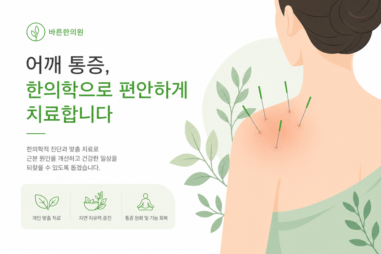 한의원 치료실에서 어깨에 침·약침 시술을 받는 환자 일러스트 (실사 아닌 친근한 그래픽 스타일). 따뜻하고 안심되는 분위기. 어깨 통증 운동 이미지