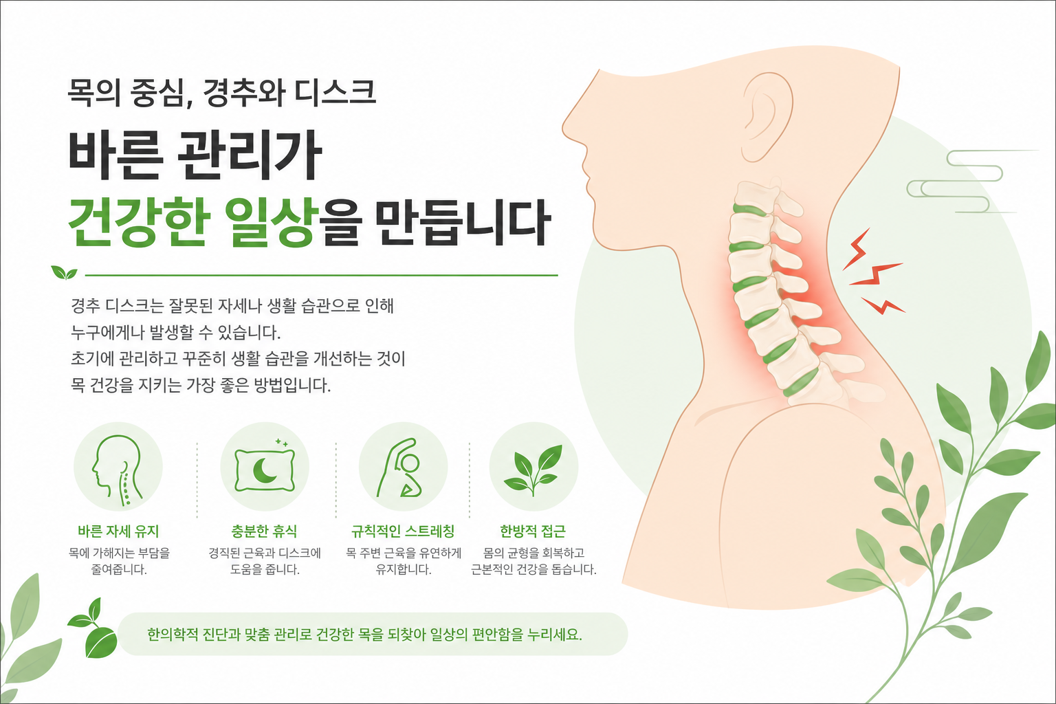 경추(목뼈) 단면 구조와 추간판 위치를 보여주는 의학 일러스트. 정상 디스크와 탈출된 디스크를 비교하는 깔끔한 도식. 이미지