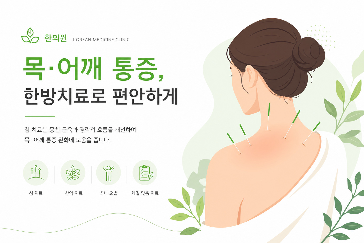 교통사고 후유증, 초기 집중 치료로 만성화를 막는 법 한의사가 환자의 목·어깨 부위에 침 치료를 시행하는 장면. 밝고 청결한 한의원 분위기. 교통사고 후유증 이미지