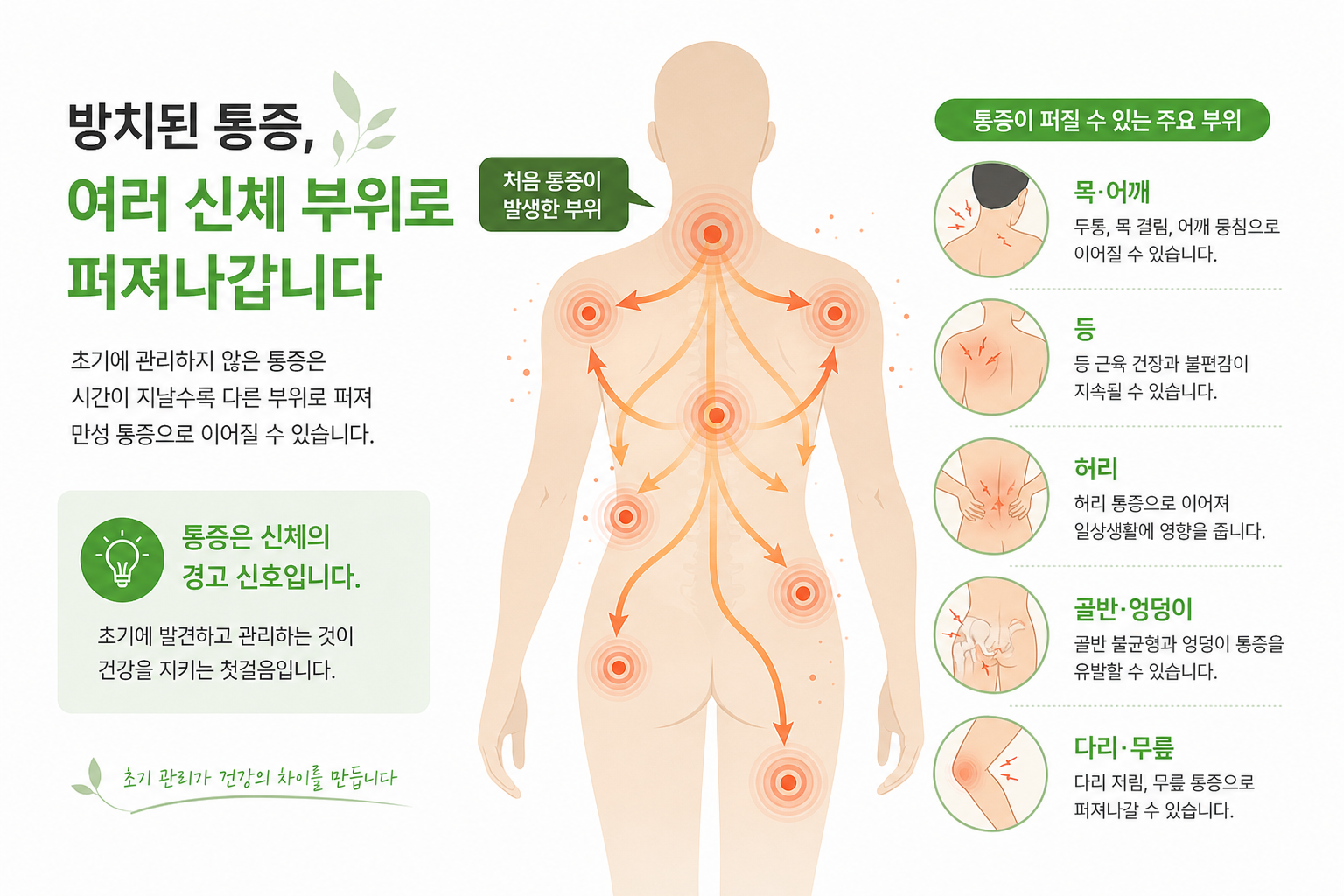 방치된 통증이 여러 신체 부위로 퍼져나가는 것을 표현하는 인포그래픽 스타일 이미지 교통사고 후유증 이미지