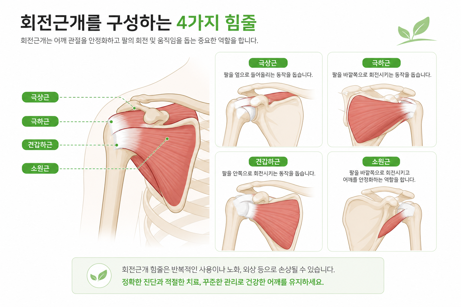 회전근개를 구성하는 힘줄 4개(극상근, 극하근, 견갑하근, 소원근) 위치를 보여주는 어깨 해부 일러스트 오십견 회전근개 감별 이미지