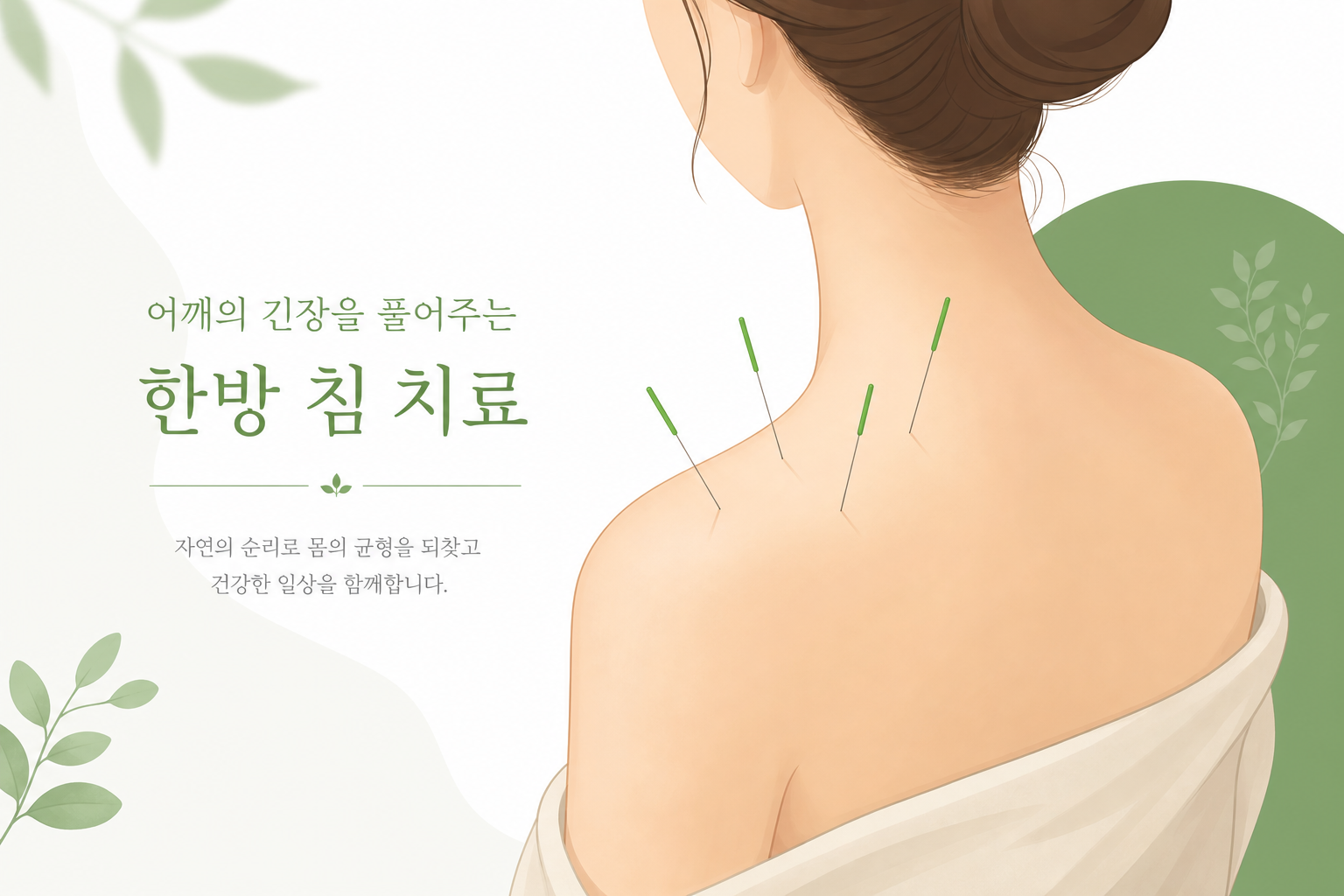 침 치료를 받는 어깨 부위를 은은하고 차분한 톤으로 표현한 이미지(시술 상세 노출 없이 분위기 위주) 오십견 회전근개 감별 이미지
