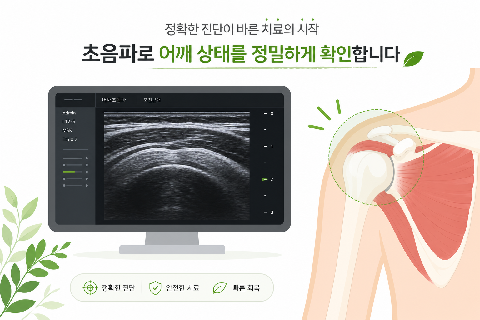 만성 어깨 통증, 초음파가이드 액와신경 약침 치료가 도움될까요 초음파 장비 화면과 어깨 부위를 함께 보여주는 개념적 일러스트 (실제 시술 장면 묘사는 지양) 액와신경 약침 치료 이미지