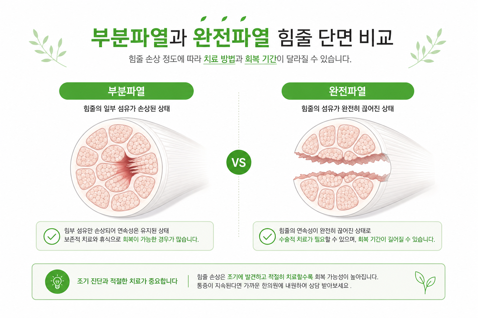 부분파열과 완전파열 힘줄 단면을 비교하는 단순 도식 일러스트 회전근개 파열 자연치유 이미지