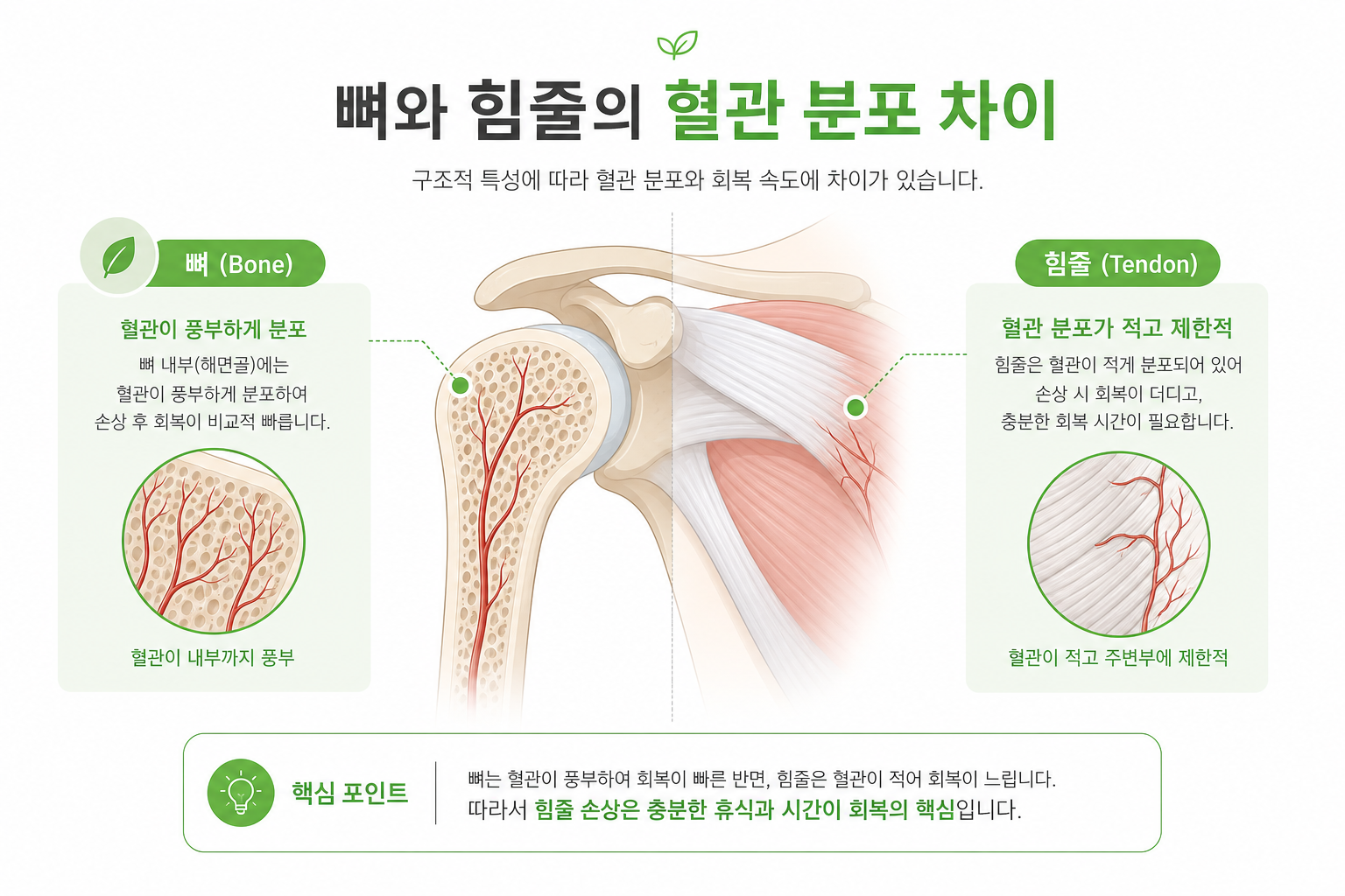 뼈와 힘줄의 혈관 분포 차이를 보여주는 단순 인포그래픽 느낌의 어깨 관절 일러스트 회전근개 파열 자연치유 이미지